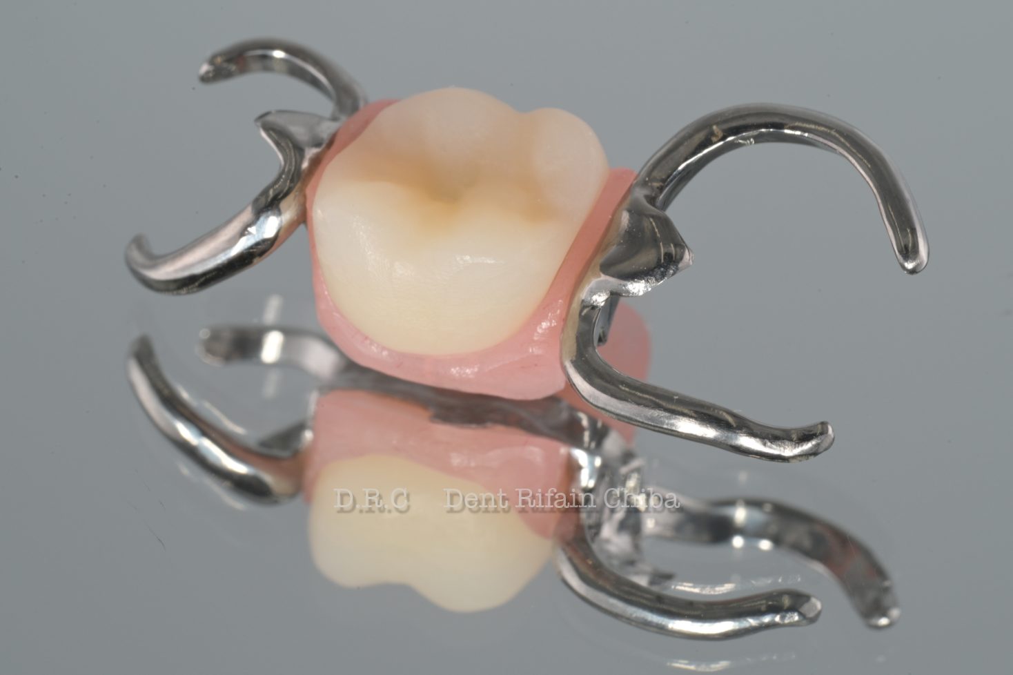 IOSデータによるパーシャルデンチャーの設計 | D.R.C歯科技工所